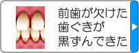 前歯が欠けた・歯ぐきが黒ずんできた