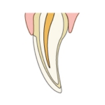 見た目がキレイに改善されました